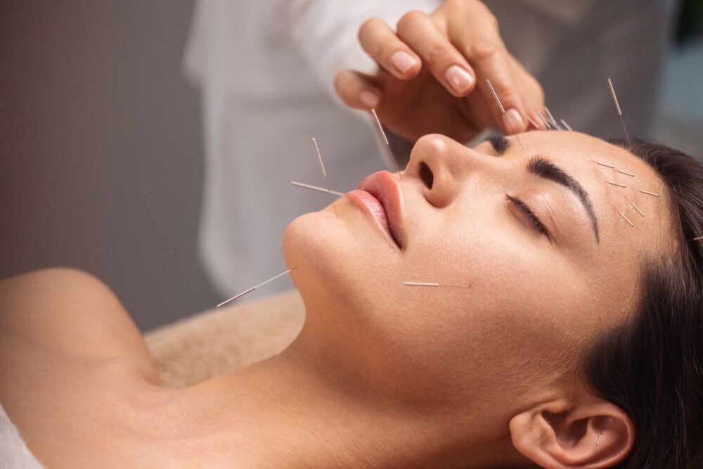 Rejuvenate Naturally with Cosmetic Acupuncture by Paul Rockliff